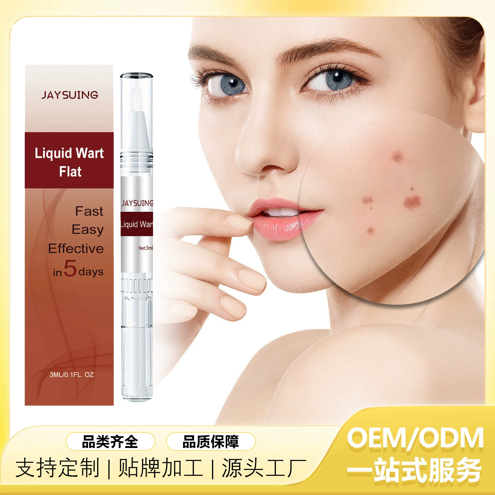 Ручка для удаления кожных новообразований Jaysuing: гладкая кожа, бережное очищение, лечение папиллом и кожных бородавок