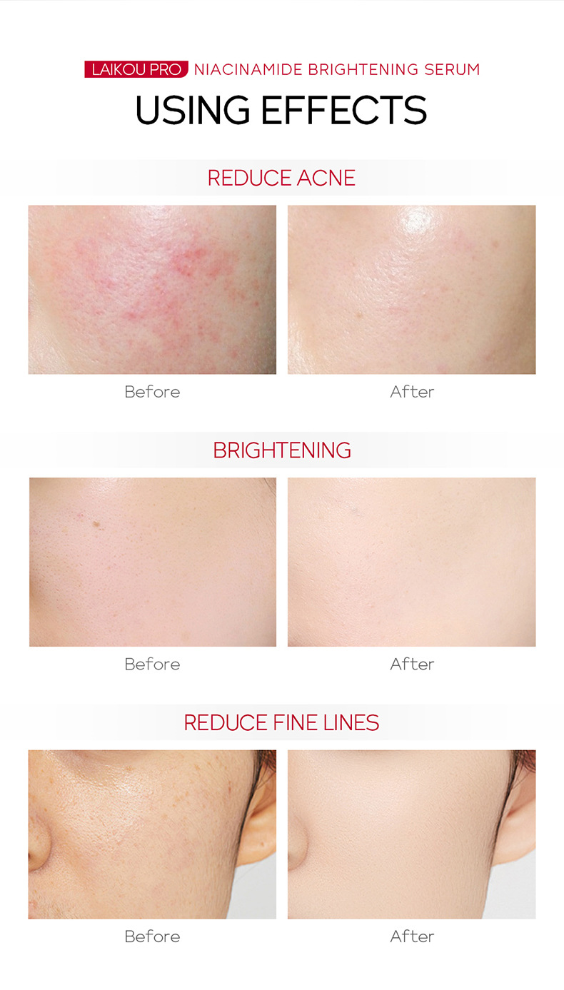 The cross-border new product, Laikou PRO Niacinamide Brightening and Hydrating Essence 17ml, is available from a skincare and cosmetic manufacturer undefined