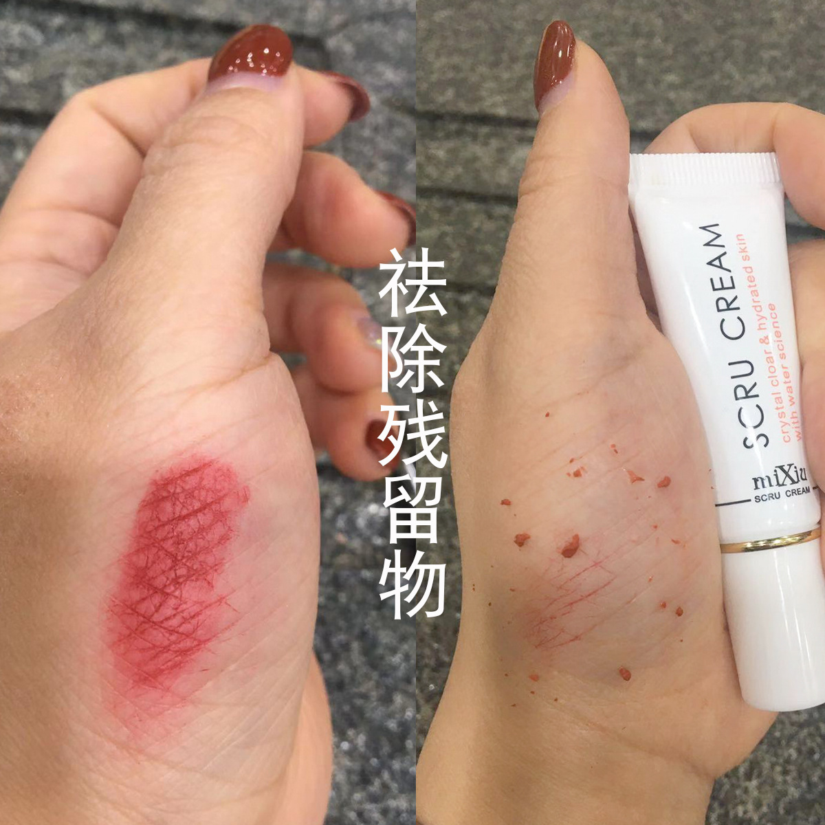 Exfoliating medical moisturizing gel