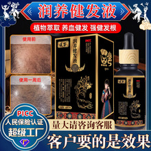 �Ȱ��~�������B���lҺ�F؛�̝��^Ƥ�澏�l�|�ɿ�ë��ı������lҺ