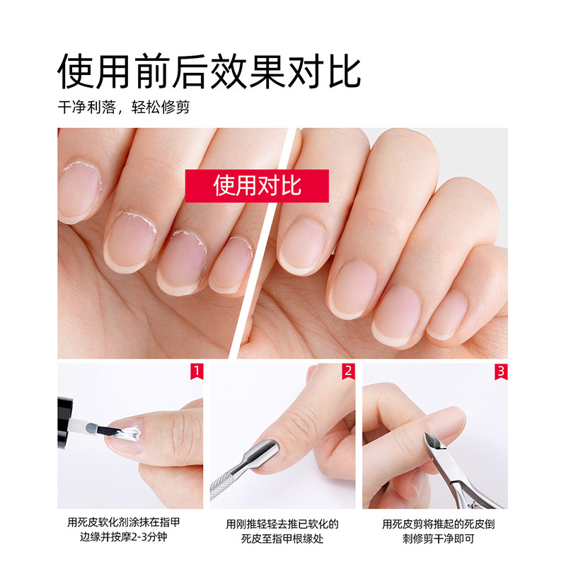 Cizallas para la piel muerta de acero inoxidable para uñas