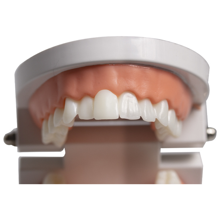 Modelo dental de práctica para la enseñanza de estética dental, adhesión y extracción de piezas de prótesis, dientes de porcelana completa para práctica de veneer.