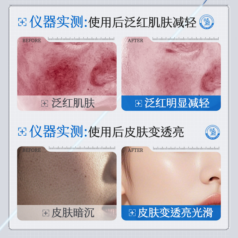 源头直供碧素堂传明酸精华液紧致焕颜补水保湿锁水舒缓全肤质适用|undefined
