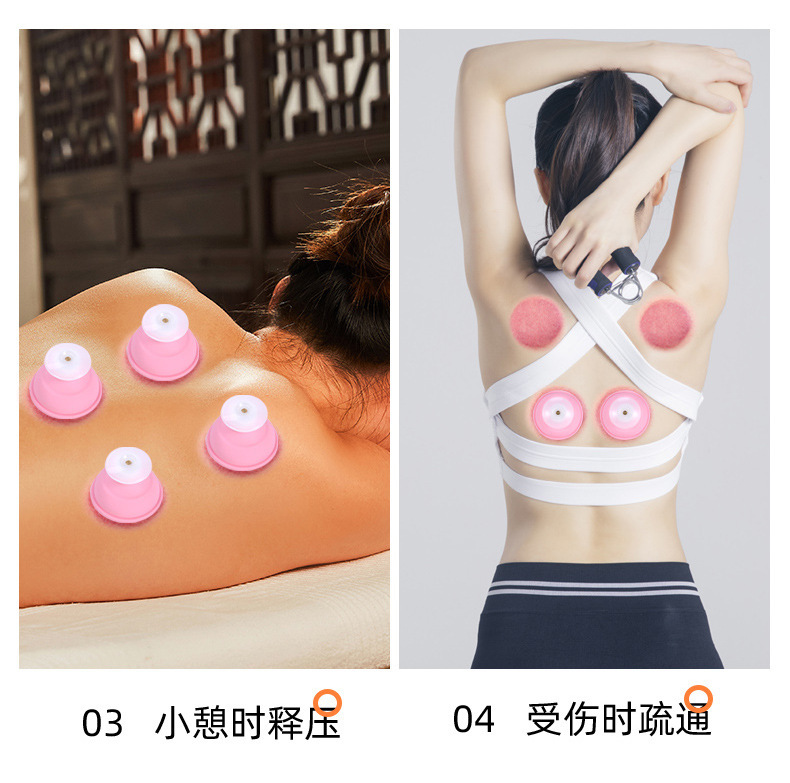 シリカゲルの缶抜き経絡が厚い真空缶器の缶抜き缶を押して吸引して負圧マッサージして携帯します。|undefined