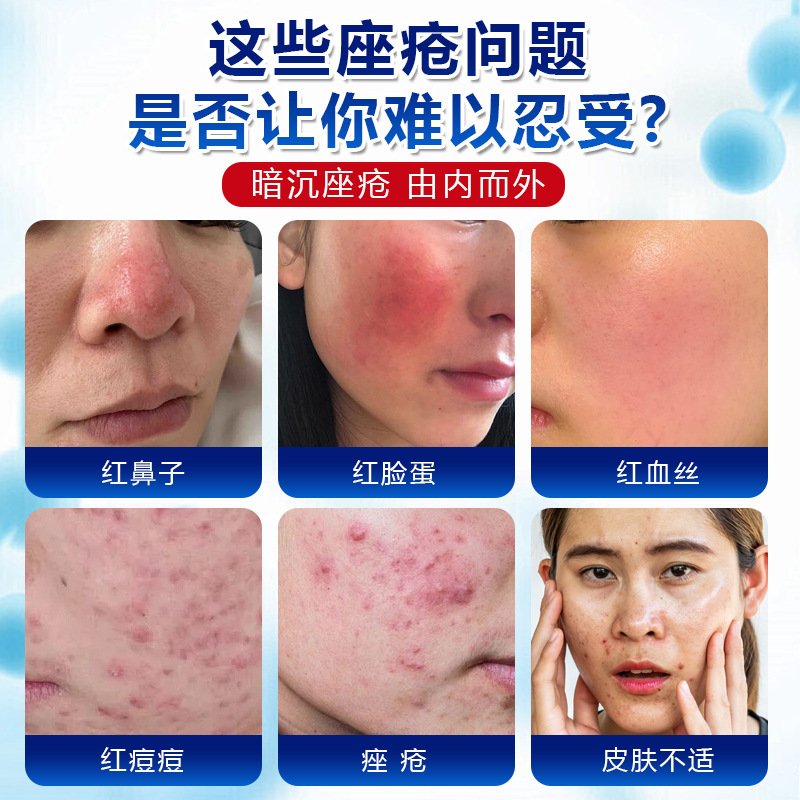 德国靡浩览娅玫瑰痤疮膏暗沉痤疮痘痘痘坑痘印修复膏护理膏清洁膏|undefined