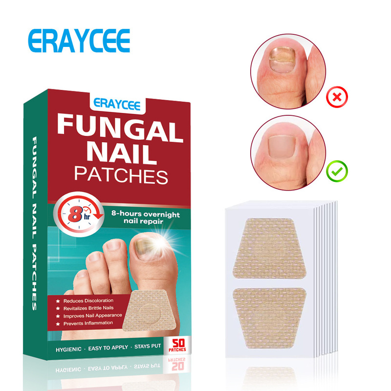 Eraycee Cross-Border Foot Nail Patch Fungal Nail Patches 50 Nail Patch Onychomycosis