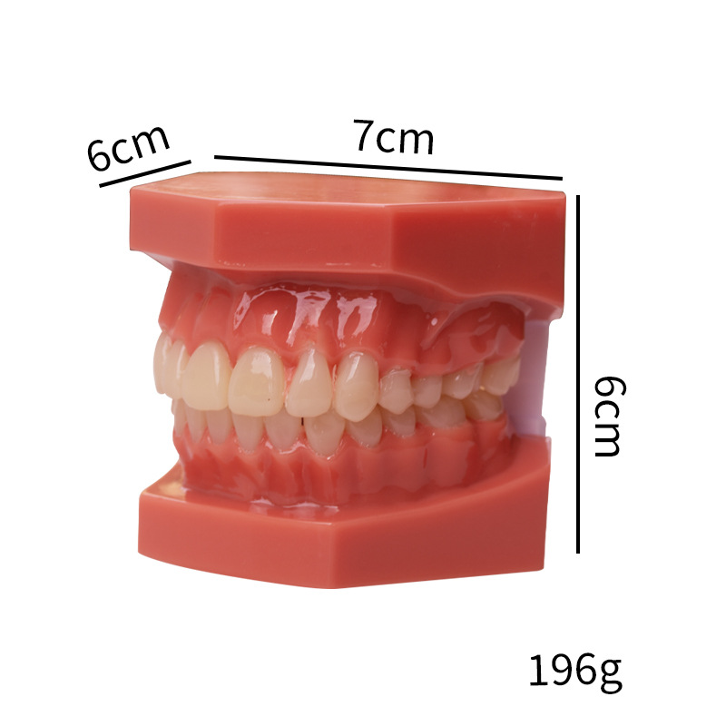 Modelo dental, modelo de corrección de demostración de mandíbula incorrecta, práctica de dentista, modelo de brackets pegajosos, molde de enseñanza de corrección