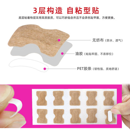 Glue-free nail patch, toenail nail groove, ingrown toenail, orthopedist, toenail patch, pull-up manicure shoes