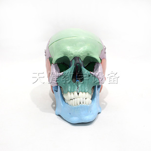 Skull color separation model (color skull) medical model
