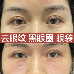 Emben Elastic Brushed Eye Cream Care Firming Removes Eye Bags and Fades Dark Circles Moisturizing Cream Peptide Anti-Wrinkle Eye Cream