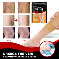 South Moon Vein Health Patch for Relieving Foot Varicose Vein Blockage and Prominence, Cold Therapy Vein Health Patch