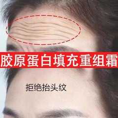 コラーゲン充填クリーム、リコンストラクションクリーム、額のしわ除去、引き締めプロテインクリーム、アンチエイジング、アンチエイジング、アンチリンクルフェイシャルクリーム