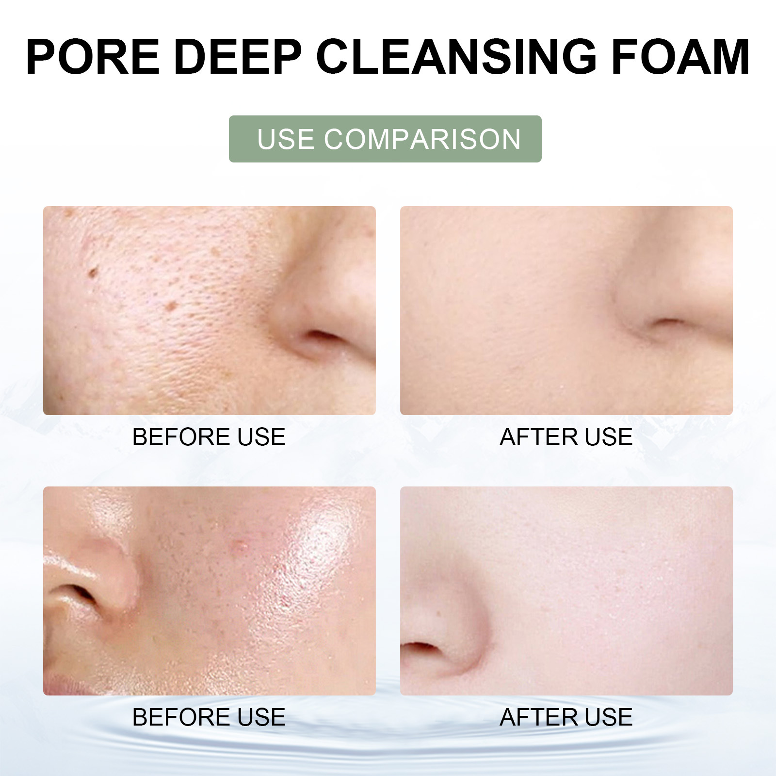 Le nettoyant nettoyant pour pores Hoygi illumine la peau du visage, nettoie en profondeur les marques d'acné, nettoie, hydrate et hydrate_voghion.com