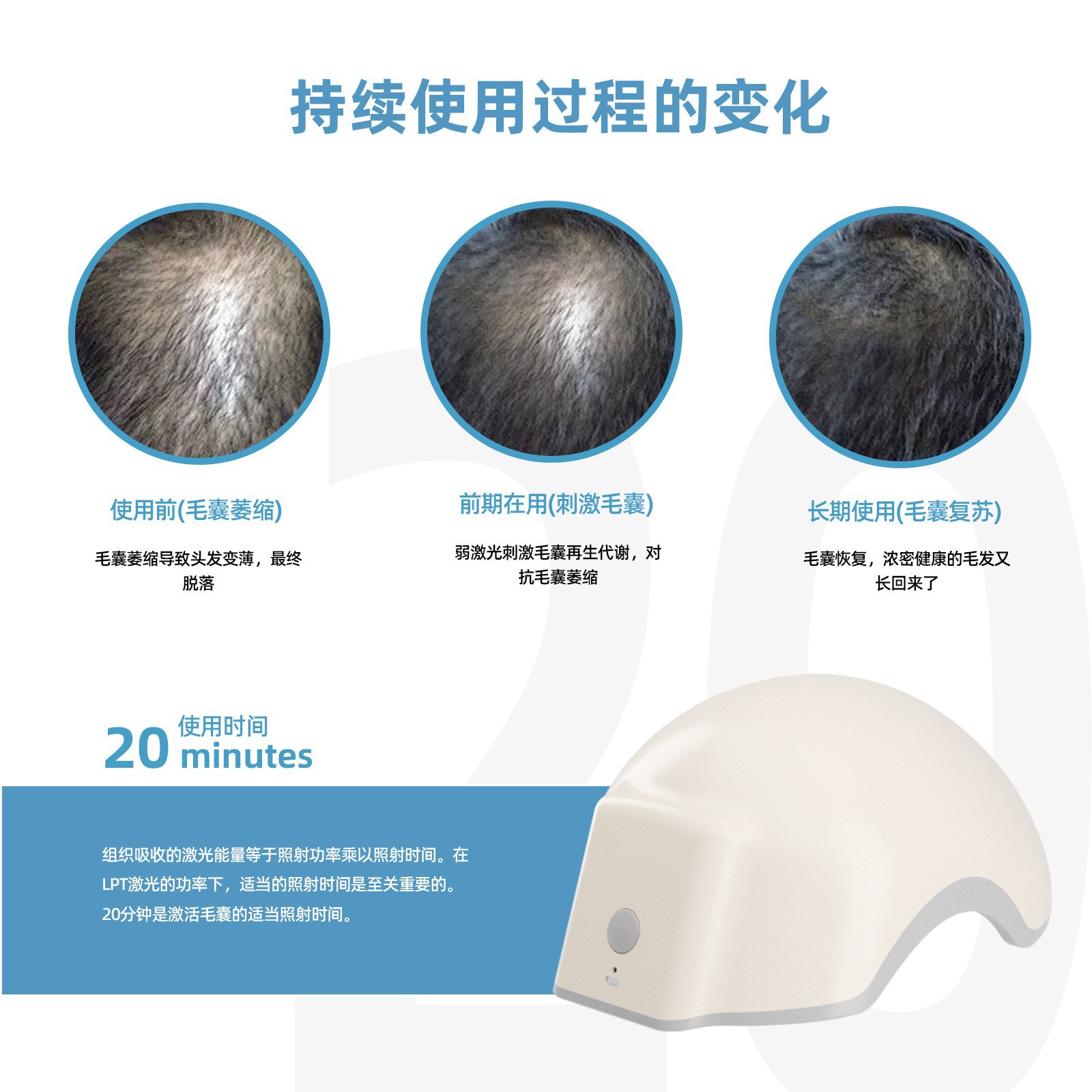 80 cuentas de Luz LED casco láser infrarrojo sólido del generador de cabello explosivo del comercio exterior se produce una eliminación masculina beneficiosa de grasa de pelo largo. image 5