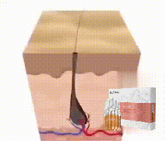 Anping EELHOE Dense Bottle Denso, forte e resistente Cura del cuoio capelluto riparatore, antigoccia, liquido per massaggio alla radice dei capelli fisso,_voghion.com