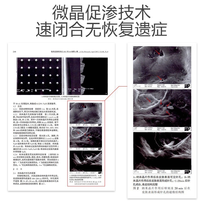 家用微晶导入米诺地儿促渗防脱育发电动微晶微针头皮上药器浅导头|undefined