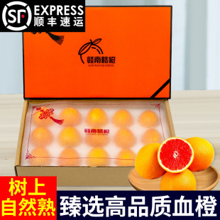 ���ͶY���]�������M��Ѫ�Ȯ������r�t����Ӹ߼��Y��Ě����S���]