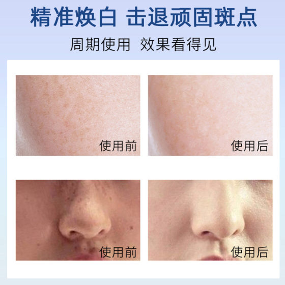 Beauty Salon Special Three-day Whitening and Brightening Kit to Brighten Skin Tone, Hydrating and Moisturizing Essence, Moisturizing and Soft Skin Set