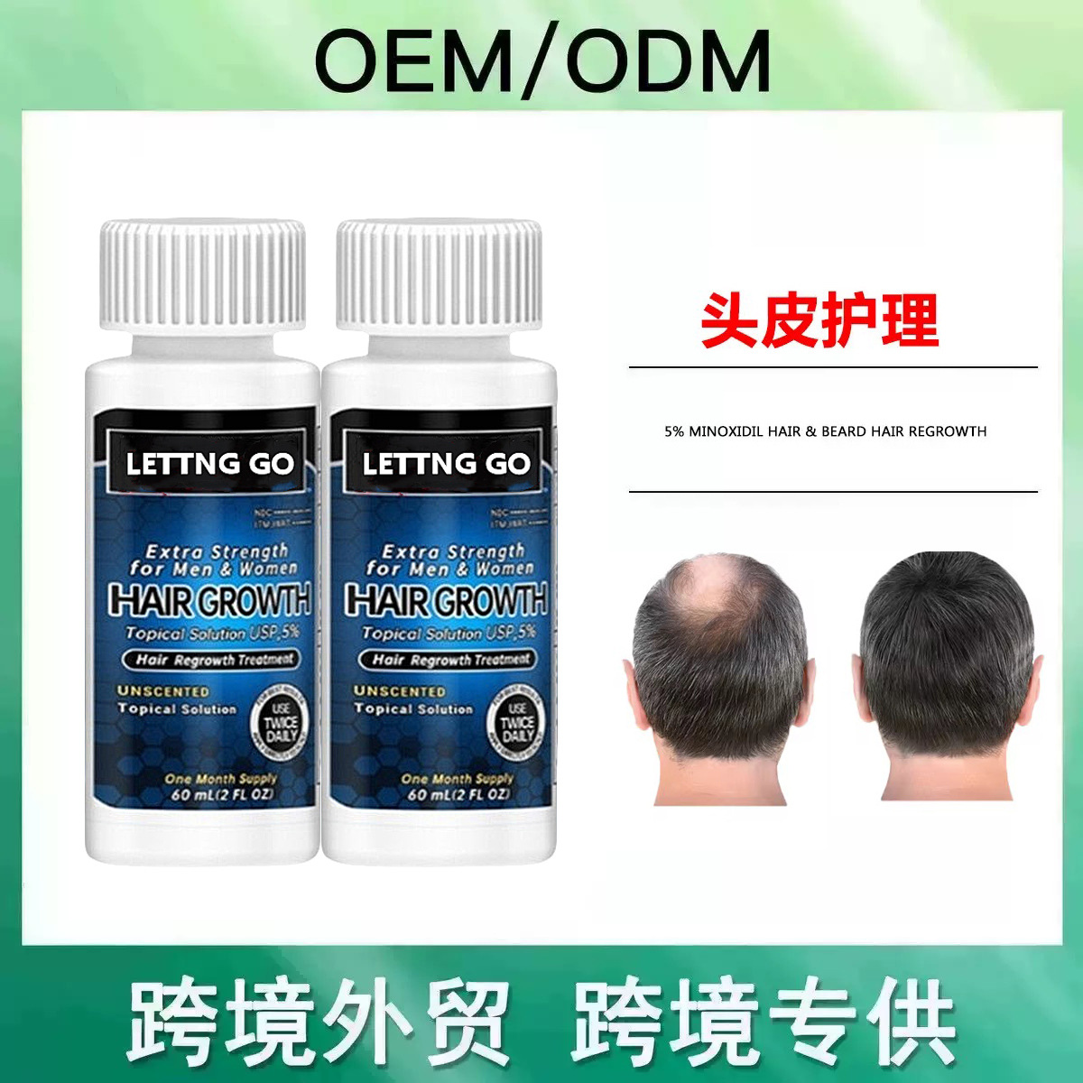 男士头发生长液5%米诺地亇酊HairGrowth全英密发液滋养头皮护发油