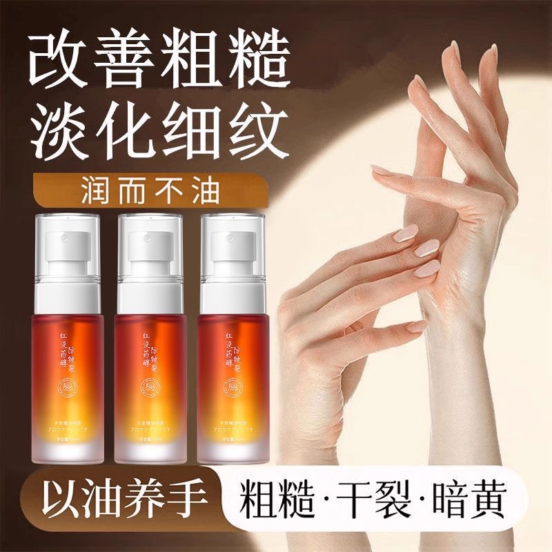 Rongqincheng Myrrhalol, spray de aceite esencial anti-agrietamiento de manos y pies, humectante, anti-agrietamiento seco, spray de desvanecimiento de marcas de manos