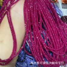 ��Ȼ���t��ʯ�A�θ�Ƭ�����朾��wͨ͸�Ƀ��o�s����Ѫ�t�t��ʯ