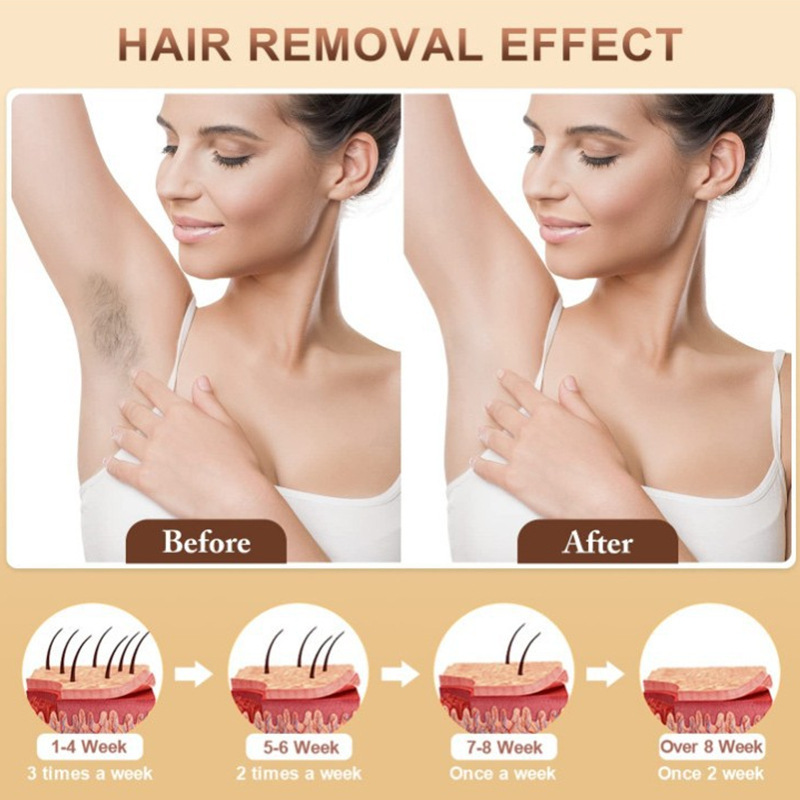 factory AI01A AI01B AI01C IPL HOME USE HAIR REMOVALMACHINE|undefined