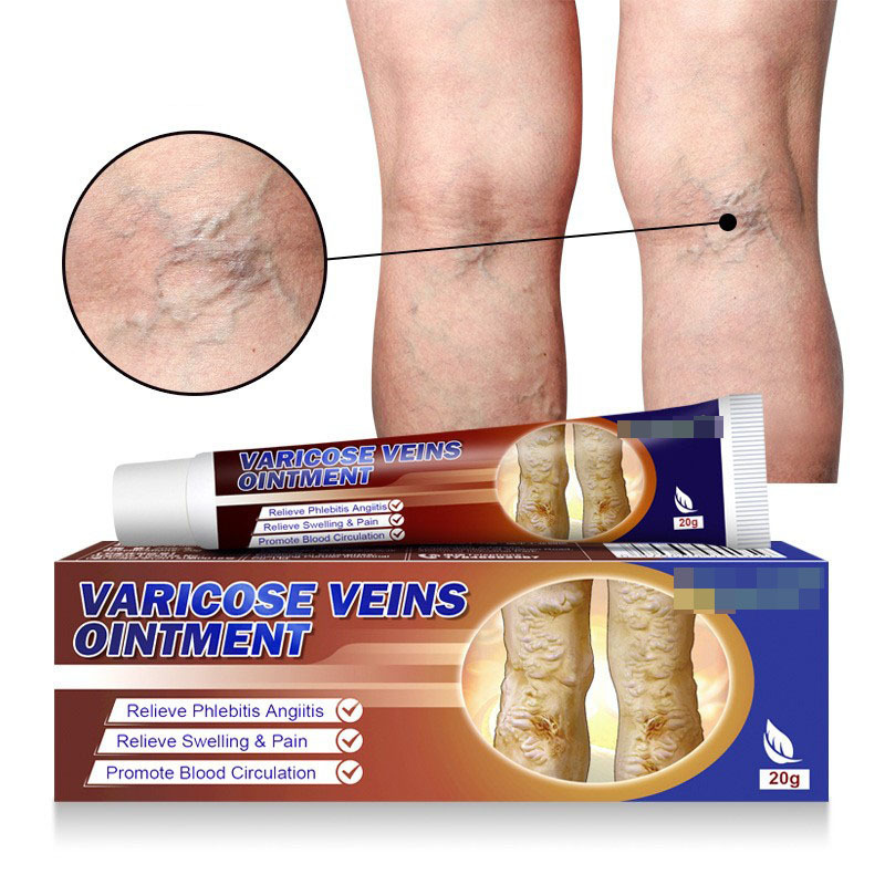 Maikang Ointment Vein Ointment Earthworm Leg Vascular Liquid wish Amazon AliExpress Lazada