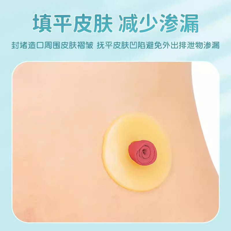 可塑造口防漏圈环防漏贴加固贴造口袋底盘造瘘护理用品密封弹力胶