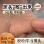 深层清洁温和粉刺导出液
