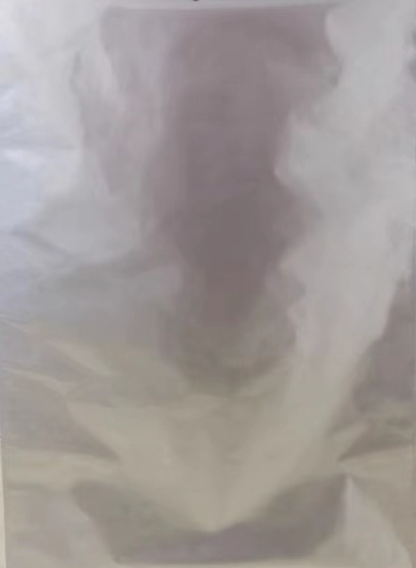 大号铝箔袋3