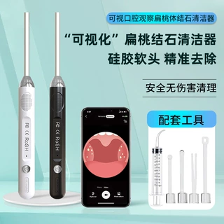 可视化扁桃体结石去除器扁桃体结石清洁工具口腔清洁护理家用定制