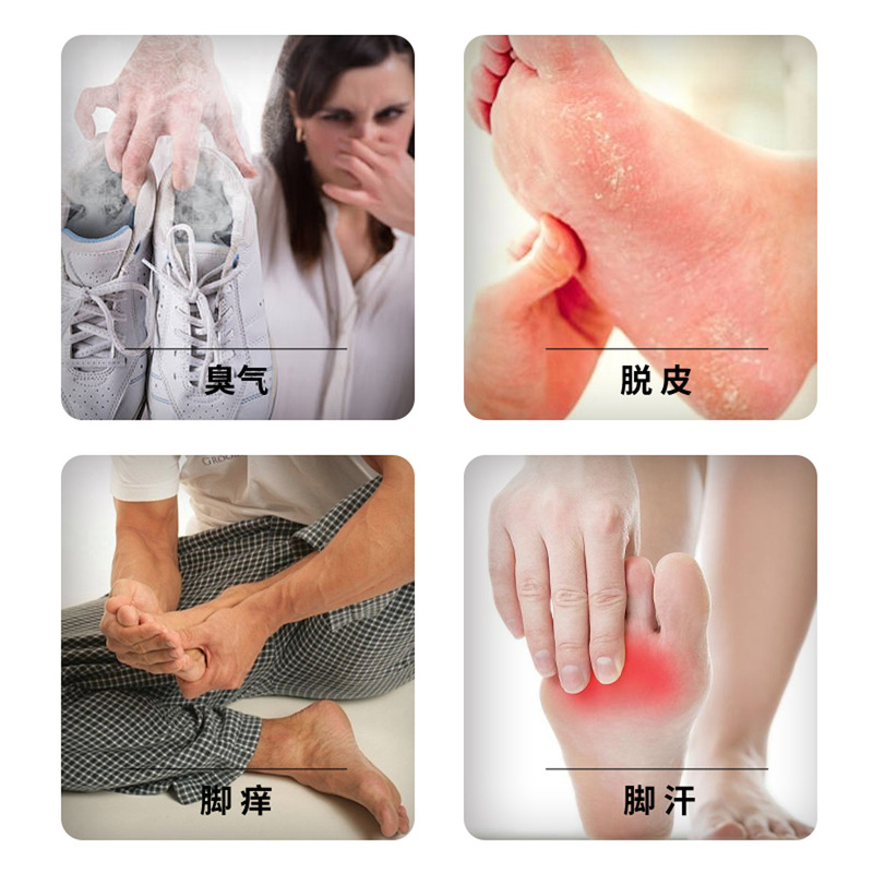 Zhongzheng Pharmaceutical 足の臭いと足の汗スプレー 足の臭いと足の汗ピーリング フットケアソリューション ウルフポイズンスプレー 足の臭いローション|undefined