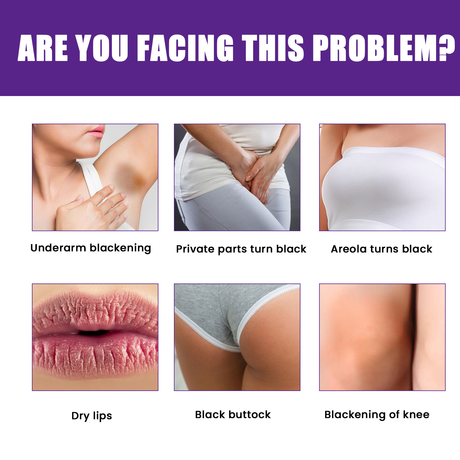 EELHOE Cremă hidratantă naturală pentru iluminare, fermitate a pielii, reduce buzele, axilele, articulațiile, melanina, cremă de albire a pielii_voghion.com