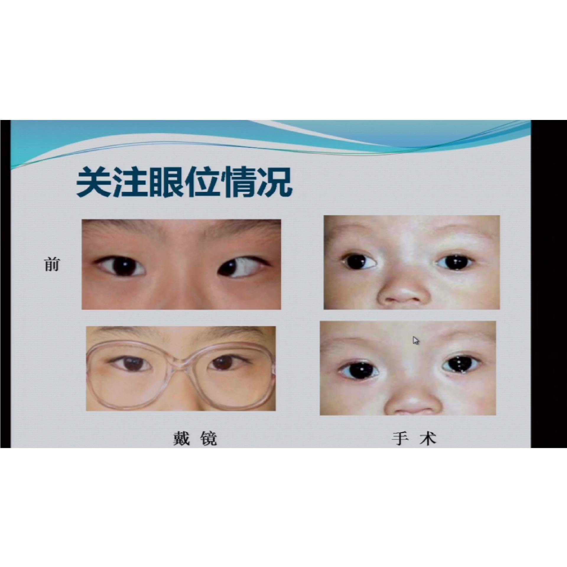 �������Ƽ��״������̣����� �γ�����