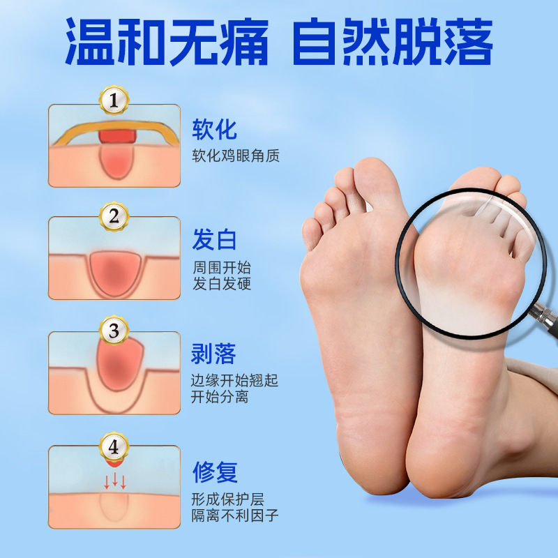 北京同仁堂鶏眼膏肉刺子繭足部看護鶏眼貼鶏眼膏|undefined