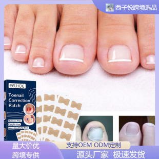EELHOE �_ָ���N ���������o�NƬ���o����ָ���坍