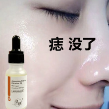 ���wõ�徫��Ę�沿��Ħ���w������aˮ�����̼��w�B�һ�����l