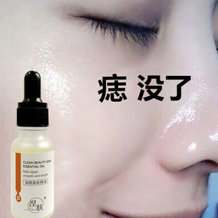 ���wõ�徫��Ę�沿��Ħ���w������aˮ�����̼��w�B�һ�����l