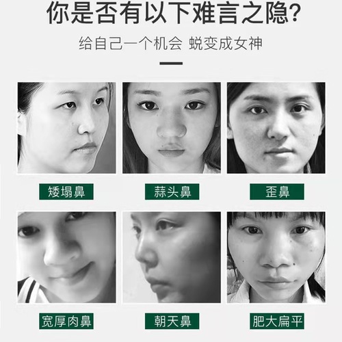 Beautiful nose essential oil, thin nose artifact, increase nose bridge, original solution, shrink nose alar, nose essence, straighten nose, facial essential oil