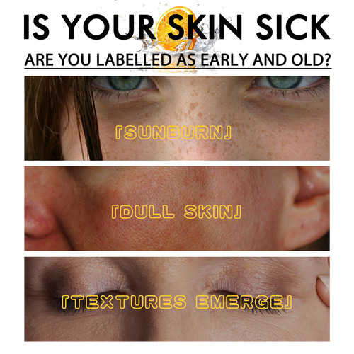 EELHOE Whitening Spot Removal Facial Essence: Fading Spots, Fine Lines, Hydration, Moisturization, Brightening Skin, Radiance