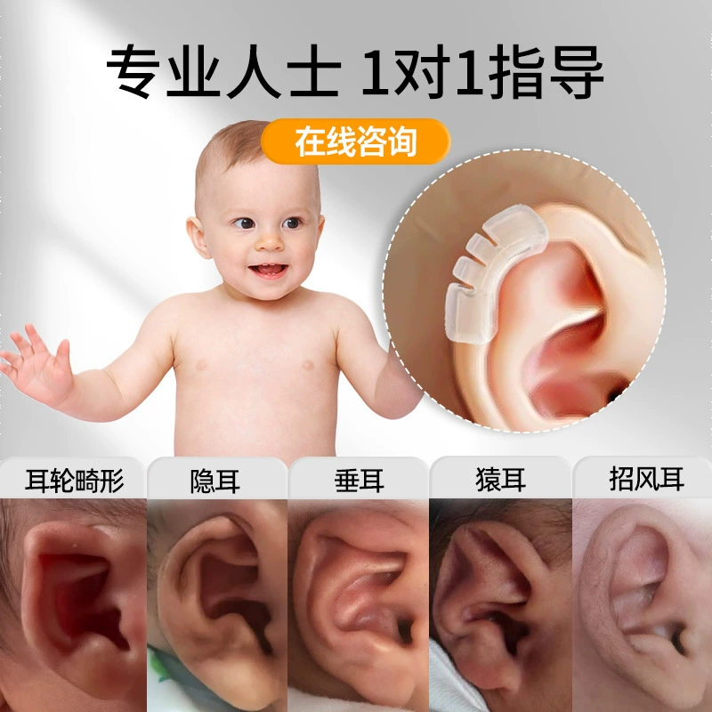 Orthotics for baby for new born for ears, silicone ear clips