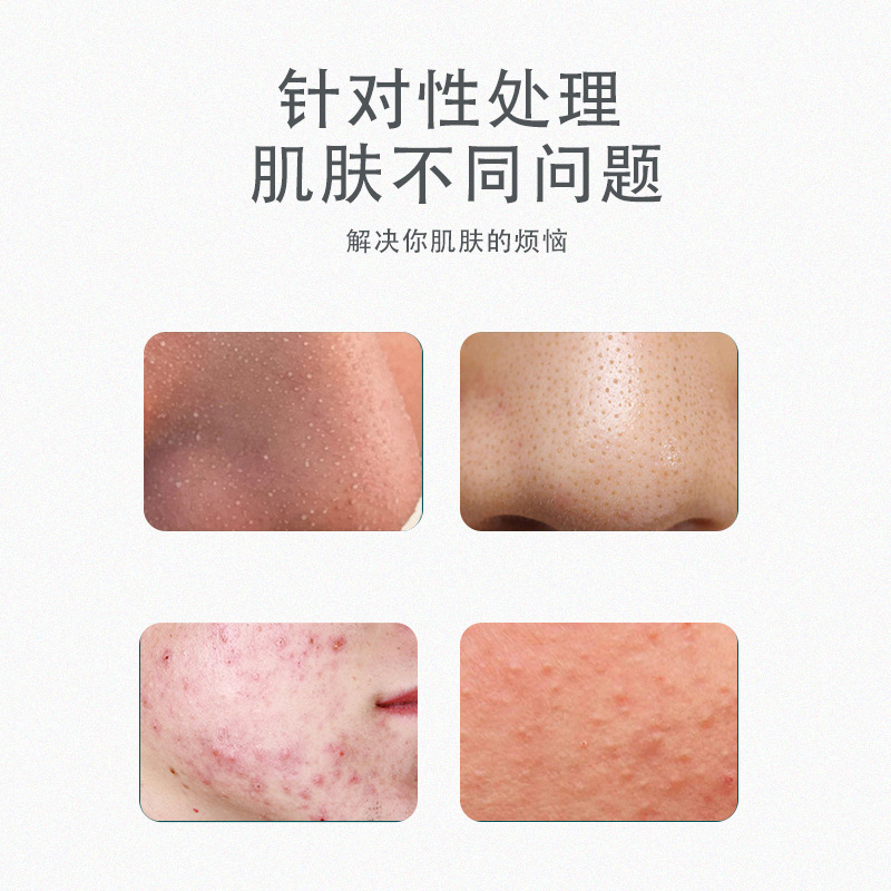 Factory Stainless Steel Blackhead Needle Set, Blackhead Cell Scraper, Closed Pore Acne Extractor, Pimple Popping Tool