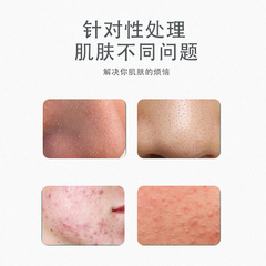 Factory Stainless Steel Blackhead Needle Set, Blackhead Cell Scraper, Closed Pore Acne Extractor, Pimple Popping Tool