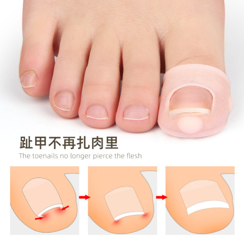 Ingrown toenail device for men and women, nail groove nail set, nail groove ingrown toenail to prevent toenail from digging into the flesh