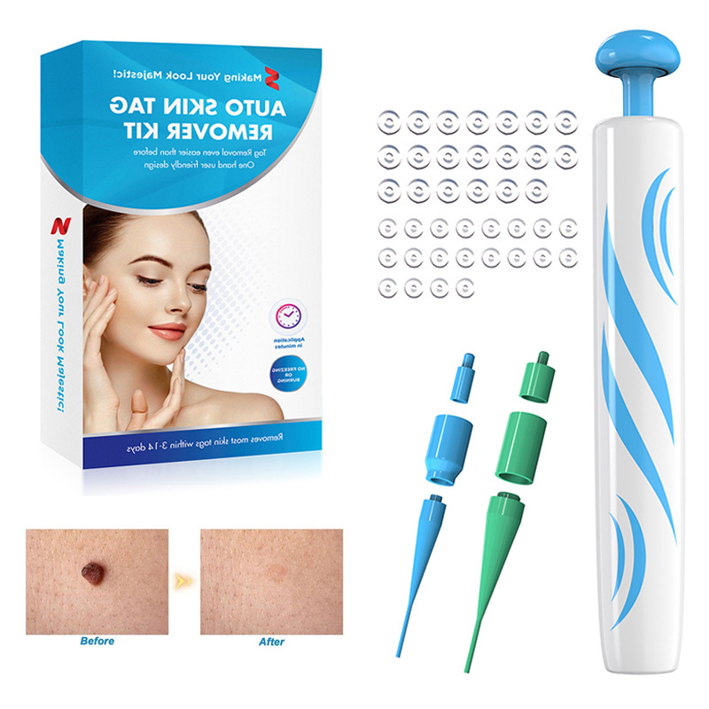 Blue Set Skin Tag Removal Kit Home Use Mole Wart Remover