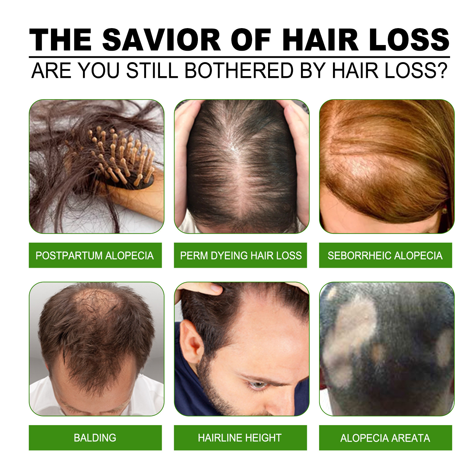 Liquido nutriente per massaggio del cuoio capelluto denso, forte e resistente, nutriente, per la crescita delle radici dei capelli_voghion.com