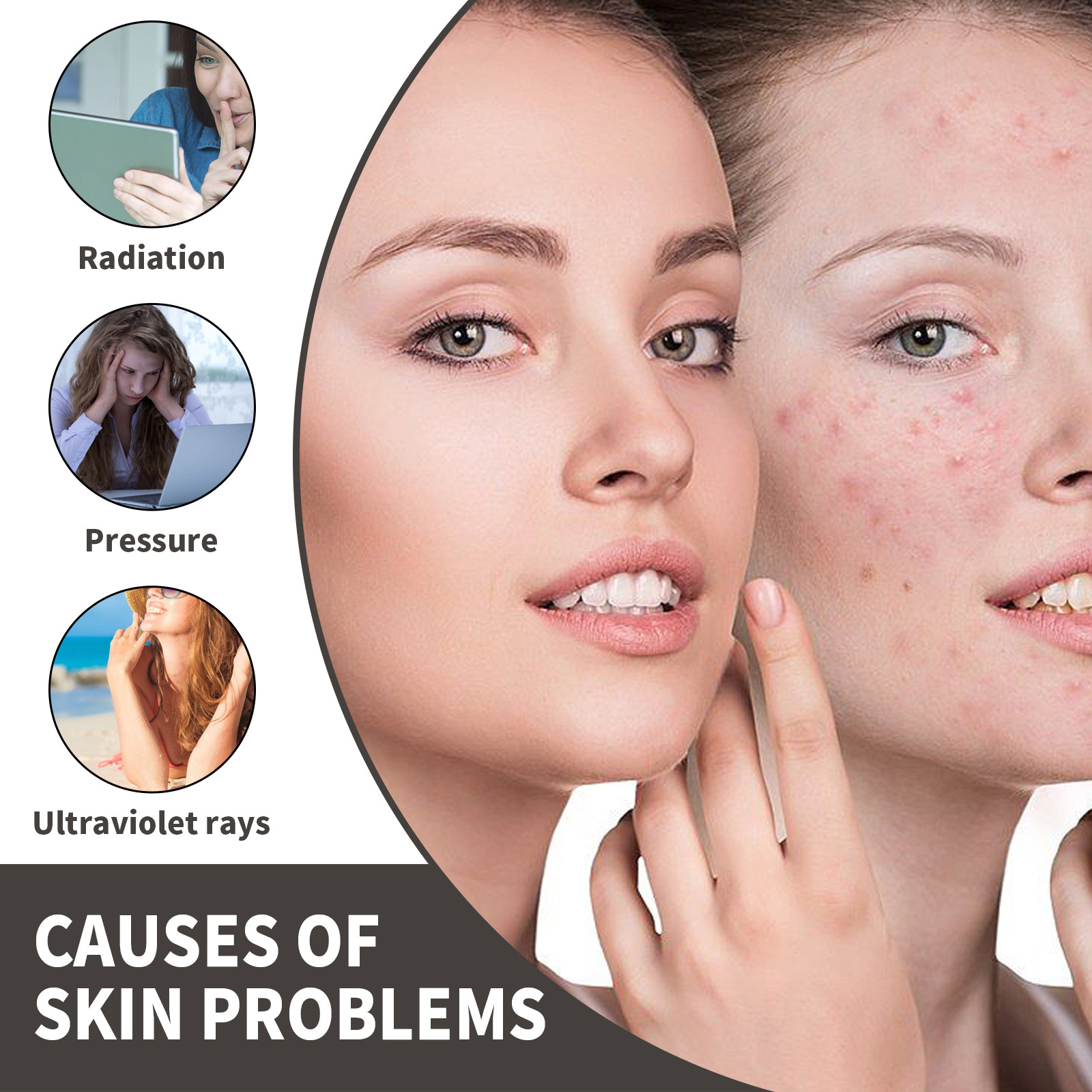 OUHOE Dark Spot&Acne för att bleka fläckar, återfukta huden, reparera aknemärken, mörka och ljusa upp ansiktets essens_voghion.com