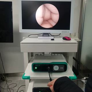 耳内镜系统 鼻内镜系统 耳鼻喉内镜摄像系统全套 