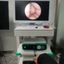 全套耳鼻喉摄像内镜内镜