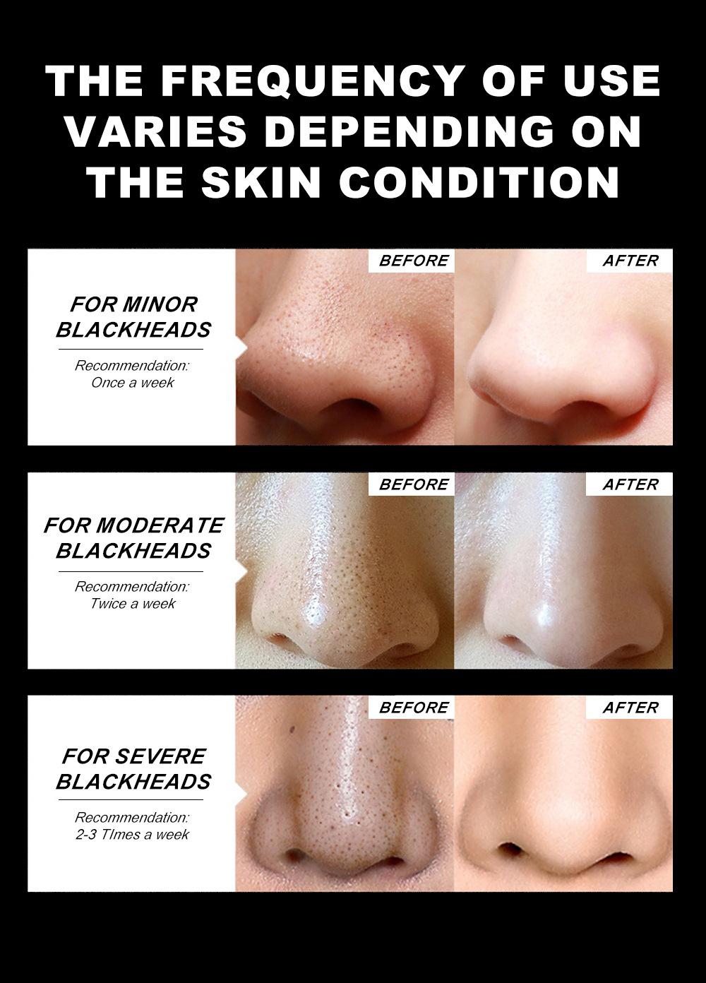 YOUNG VISION Nasal Mask 50g, peel-off Nasal Mask, Black Nasal mask undefined